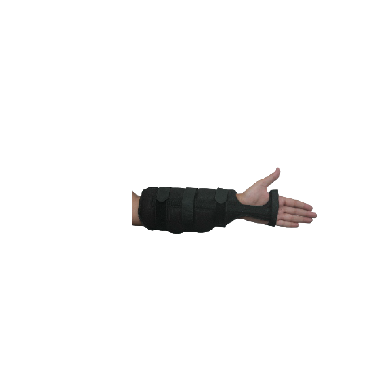 Arm Support Splint